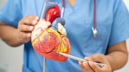 Kilka drzewek zamiast prawdziwej ochrony. Tak wygląda „zielona bariera" Panattoni w Lisim Ogonie 3 halas niskotonowy a osierdzie 150